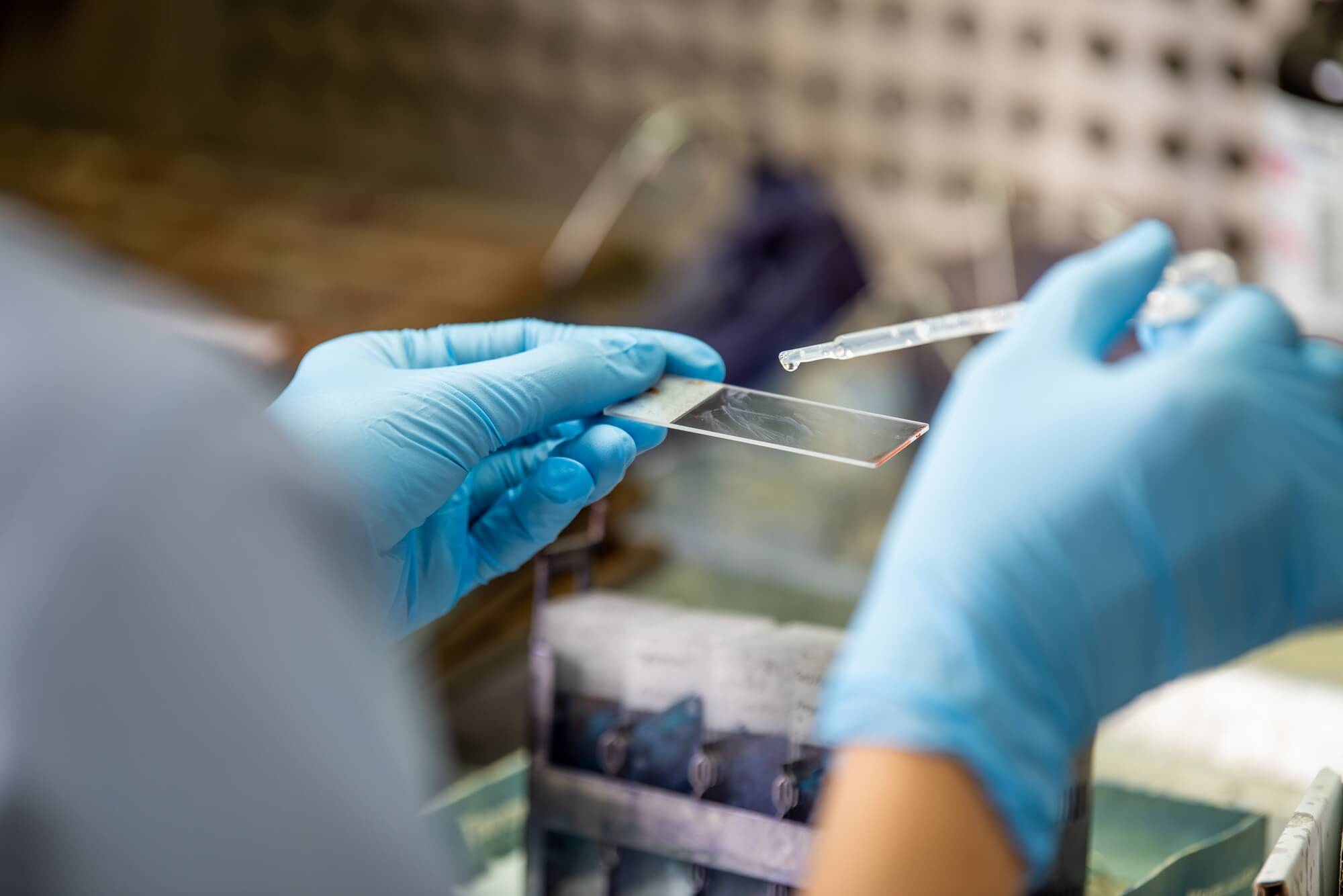 Co to jest cytologia i dlaczego każda kobieta powinna ją robić